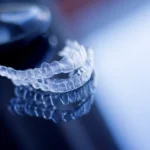 Aparat nakładkowy Invisalign